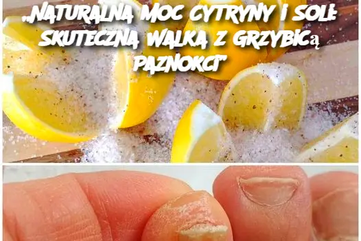 Odkryj moc cytryny i soli w walce z grzybicą paznokci