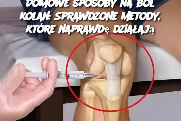 Domowe sposoby na ból kolan: Sprawdzone metody, które naprawdę działają