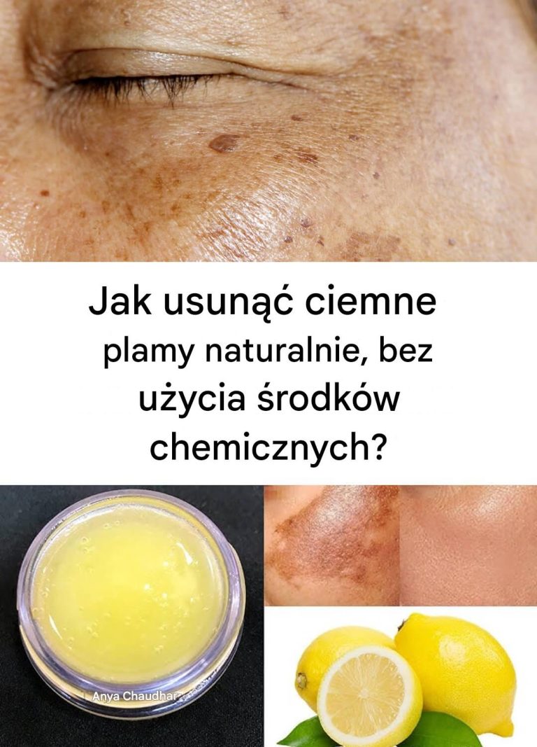 Usuń ciemne plamy naturalnie, bez chemikaliów