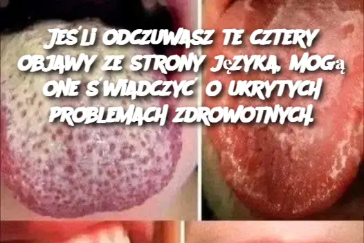 Jeśli masz to na języku, to dlatego, że masz... Zobacz więcej
