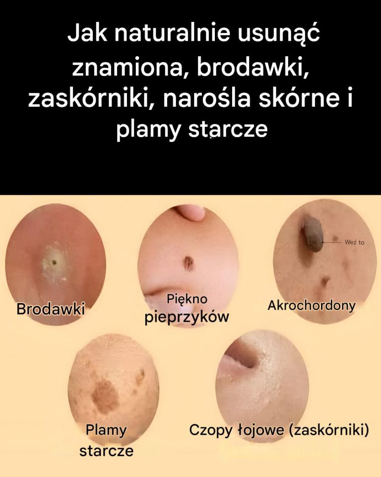 Jak naturalnie zadbać o te powszechne problemy skórne