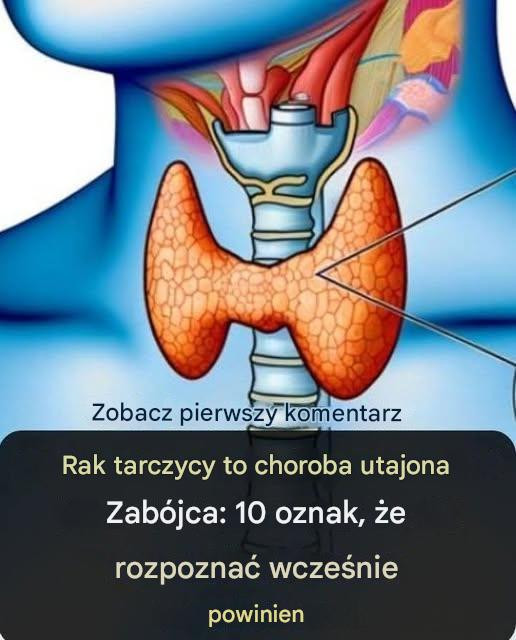 Rak tarczycy: Te trzy objawy powinny Cię zaniepokoić