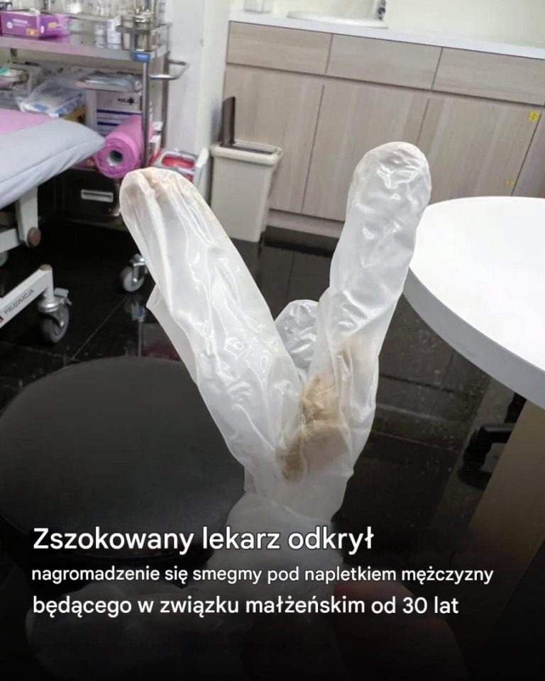 Kiedy lekarz zaczął badać, w klinice rozszedł się mdły zapach
